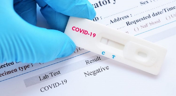 Covid-19, pandemia, clínicas de fiebre